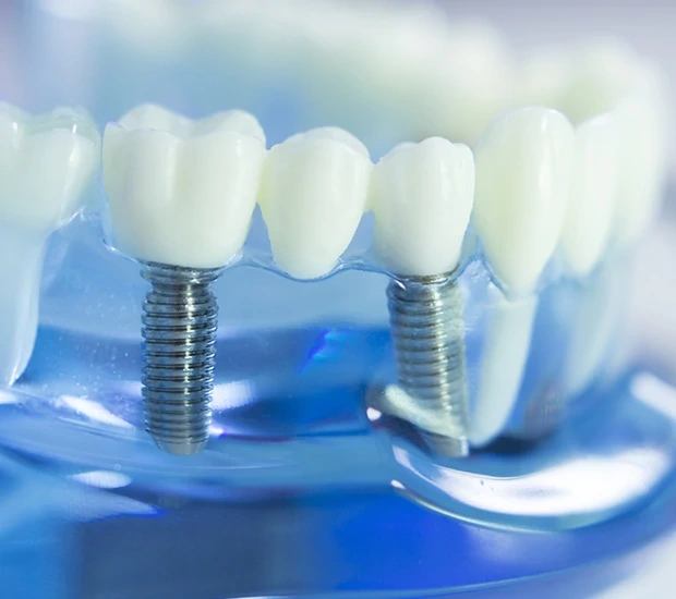 Trusted Dental Services in Sunny Isles Beach, FL - Aventura Dental Center