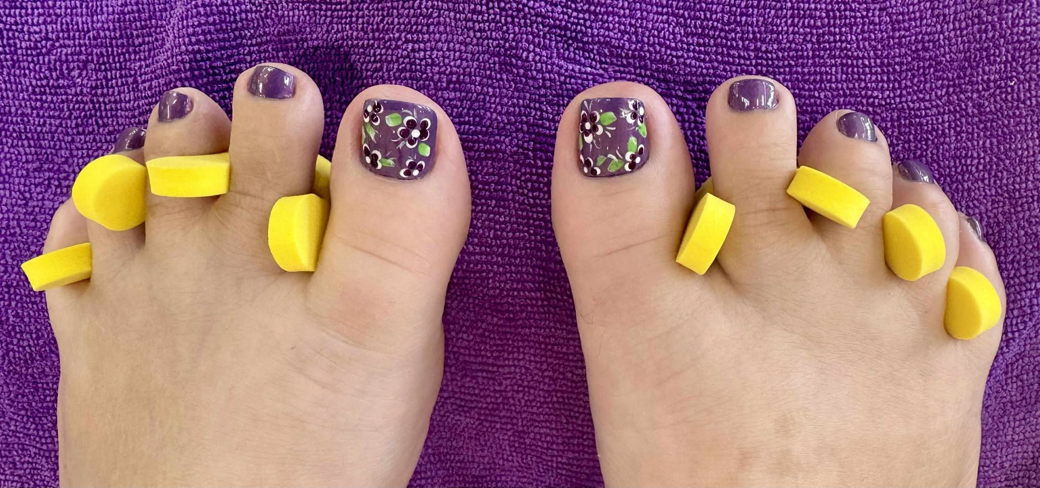 Woman's feet with yellow toe separators and purple nail polish.