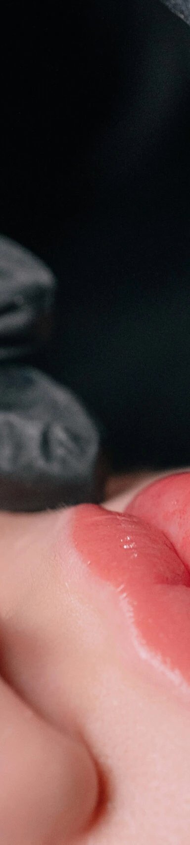 close-up of lip enhancement procedure