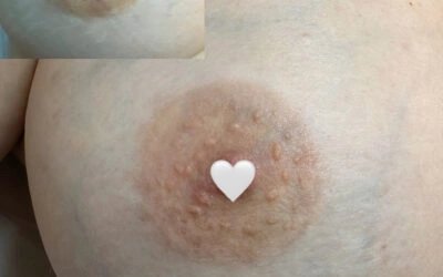 Areola Pigmentation Guide: Nipple Tattoo 101 