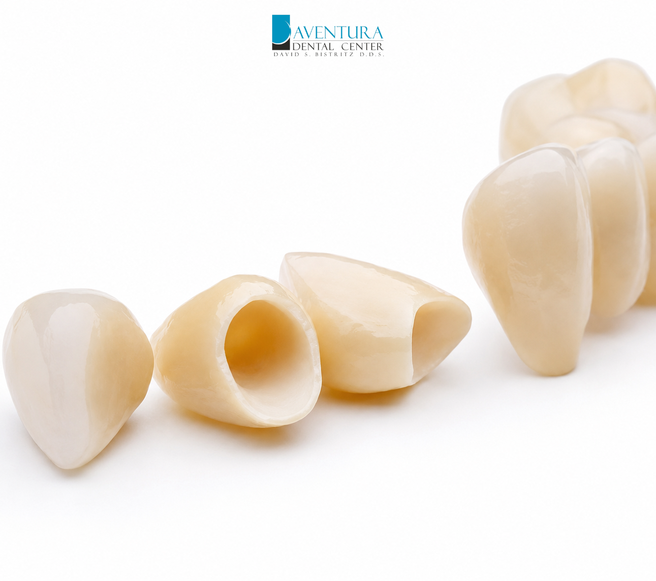 Expert Guide to Dental Crowns: What They Do and When You Need One