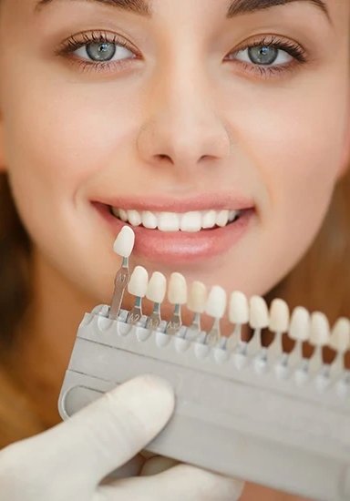 Woman displaying teeth shade guide during dental consultation