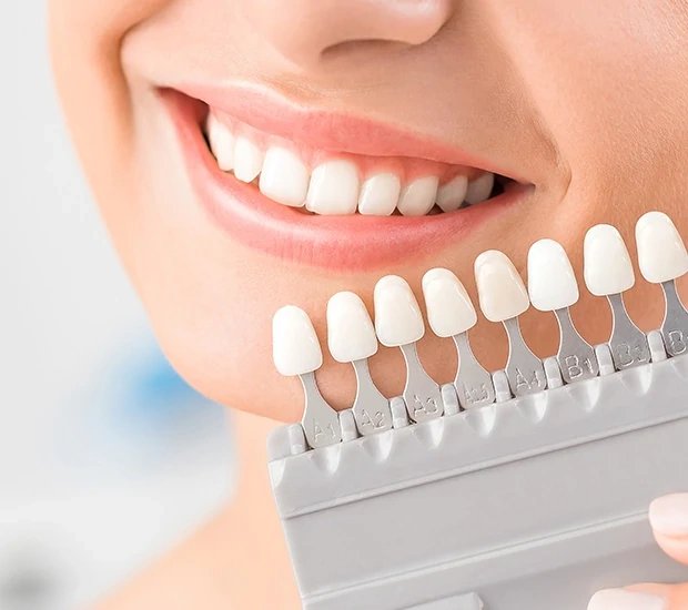 Porcelain vs Composite Veneers in Aventura, FL