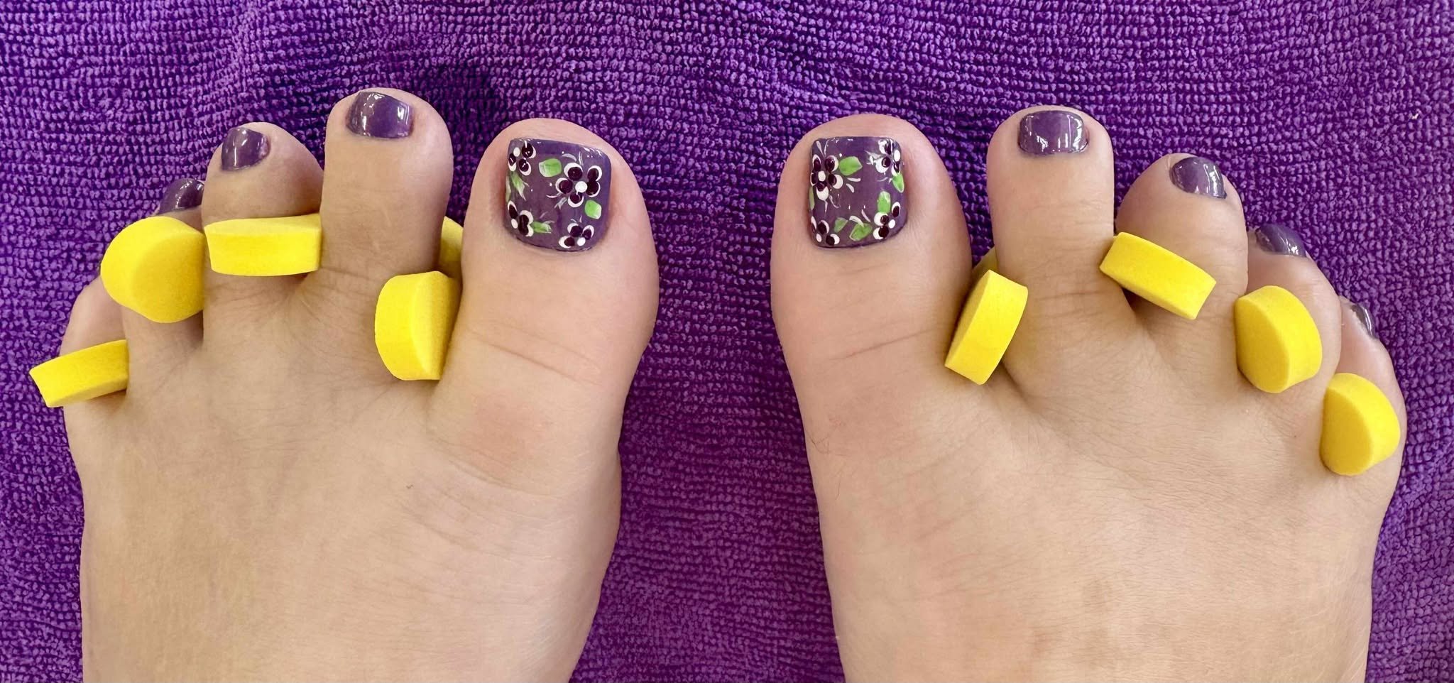 Woman's feet with yellow toe separators and purple nail polish.